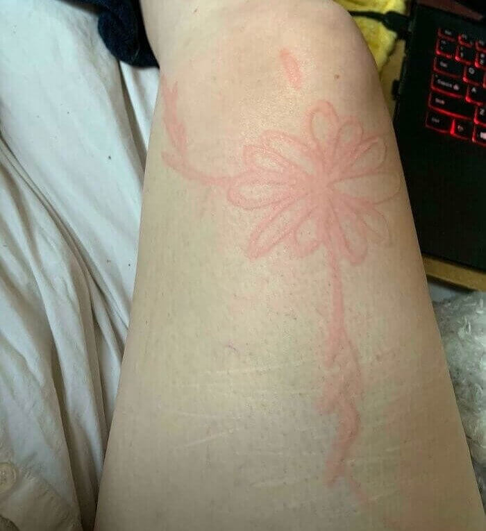 Making The Best Out Of A Unique Condition