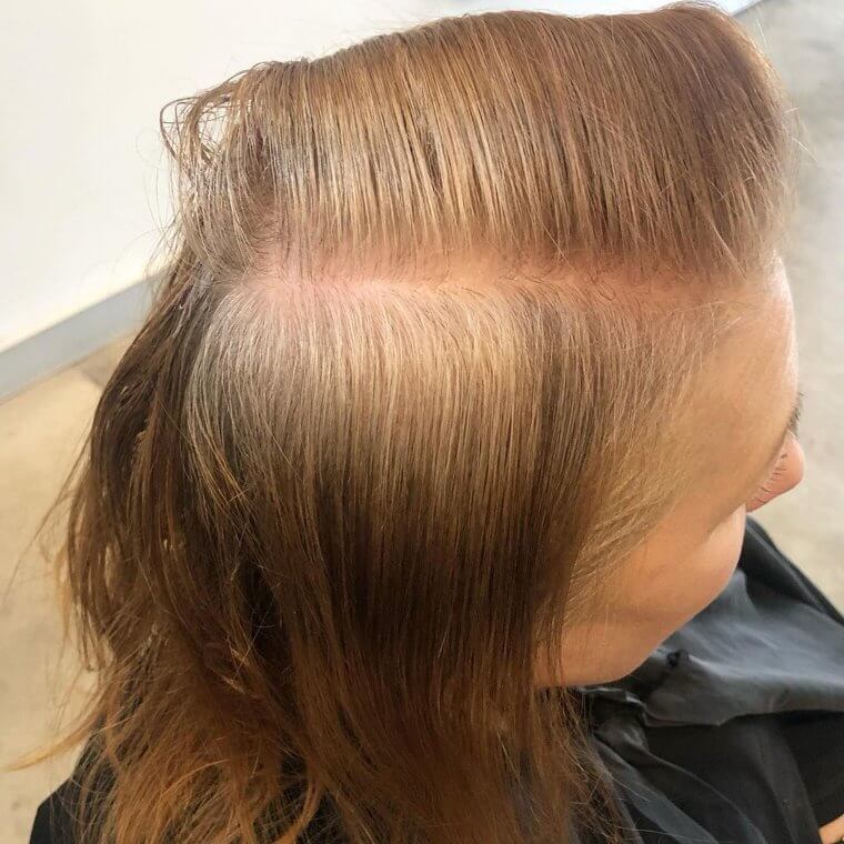 Redheads Take A Lot Longer To Go Gray