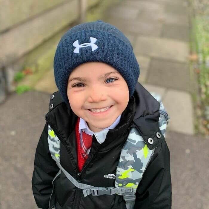 A Boy Rocking His Heterochromia