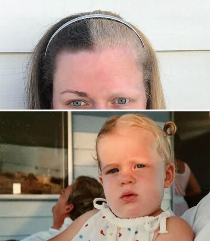 This Girl Was Born With Both Blonde And Brown Hair