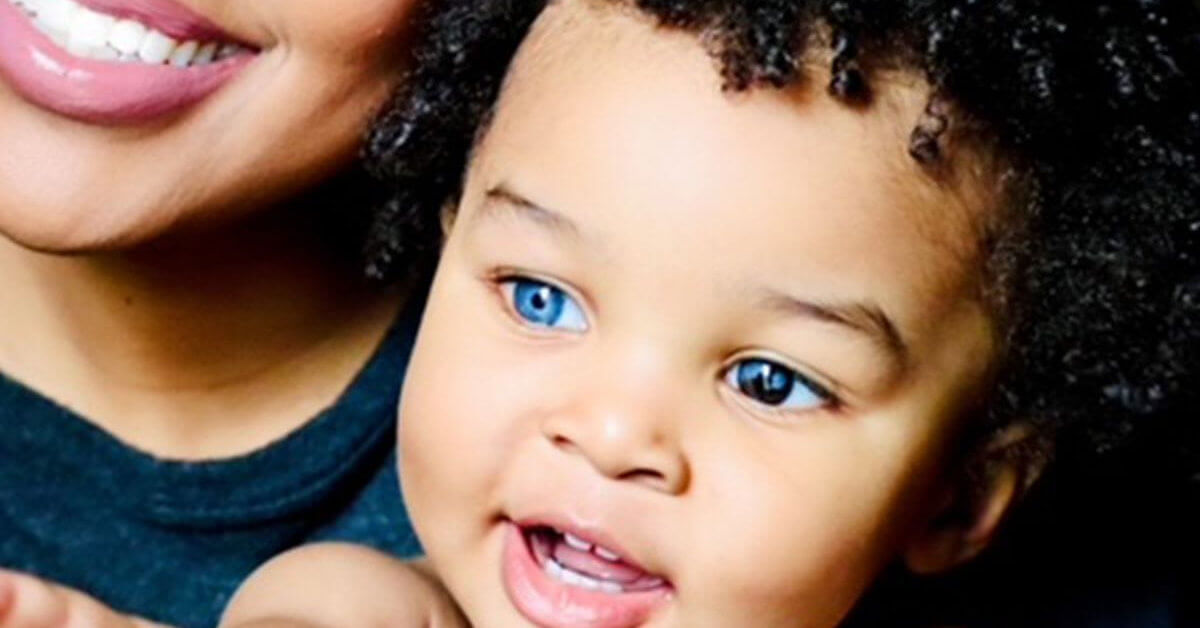 These People’s Genetic Conditions Really Make Them Unique
