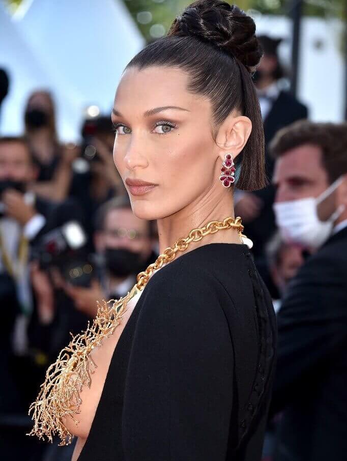 Hairline Adjustments Are a Thing in Hollywood