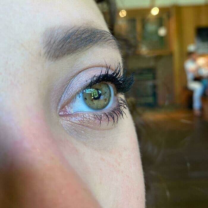 This Girls Has Freckles In Her Iris