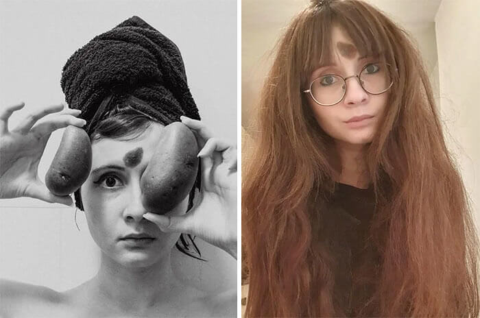 A Birthmark Shaped Like A Potato Right In The Middle Of This Girl's Forehead